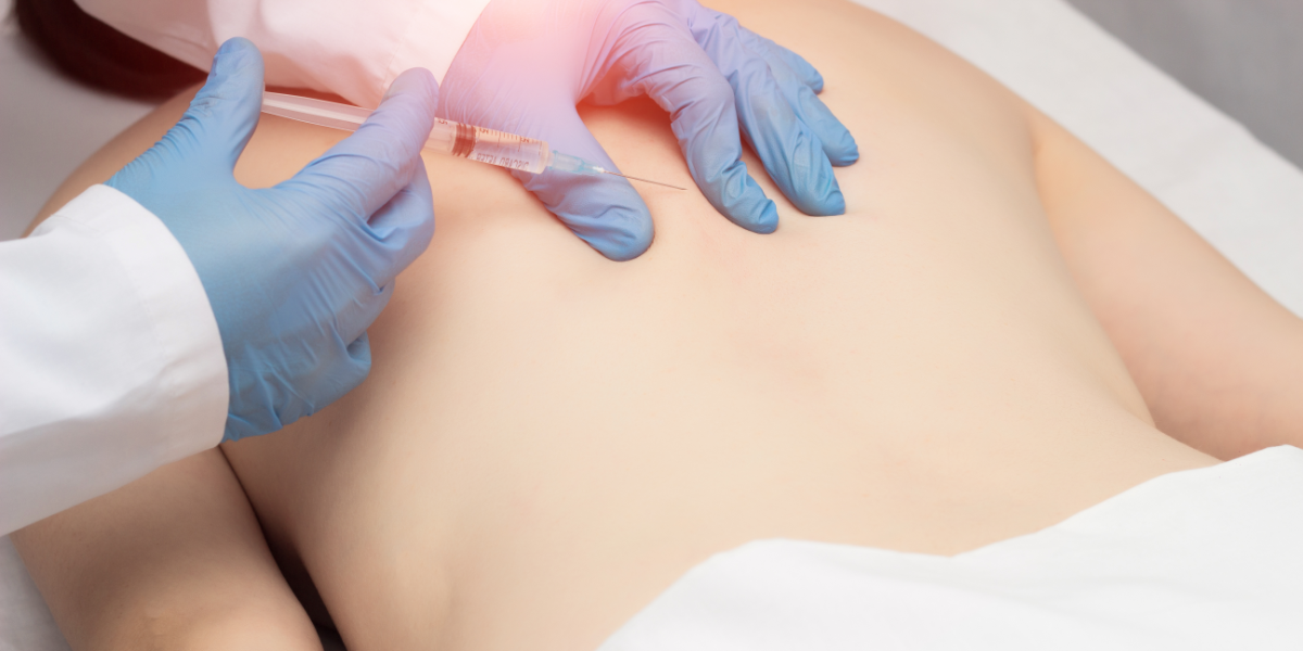 The Science and Benefits of Trigger Point Injections